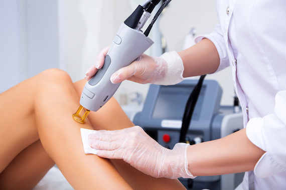Best Laser Hair Removal Treatment