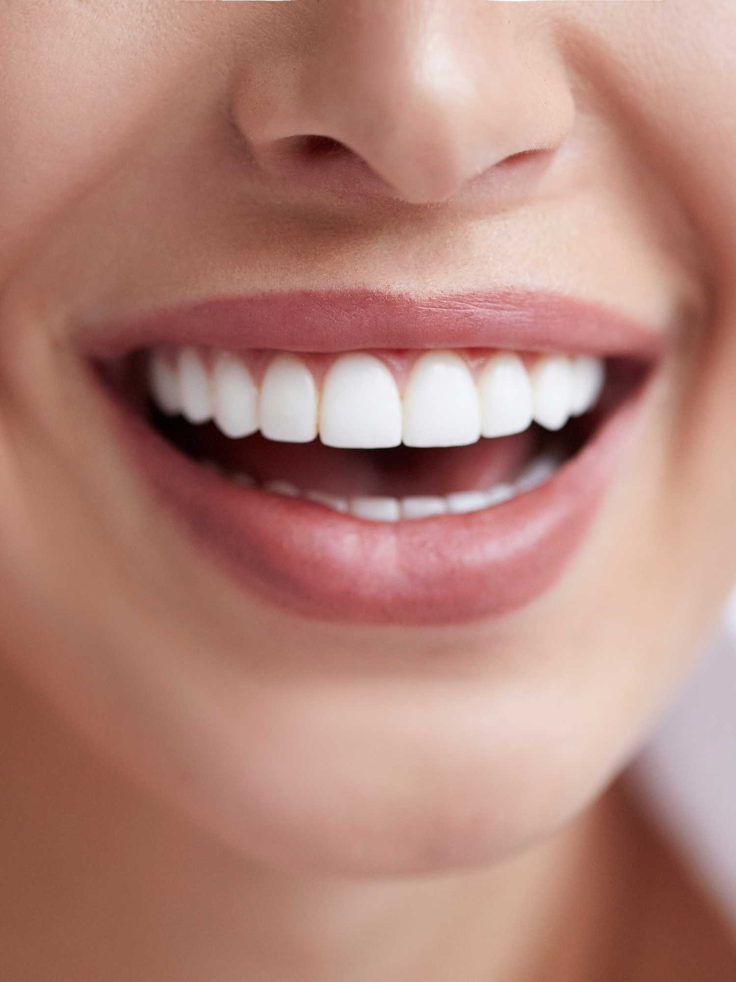 Teeth Whitening NSW