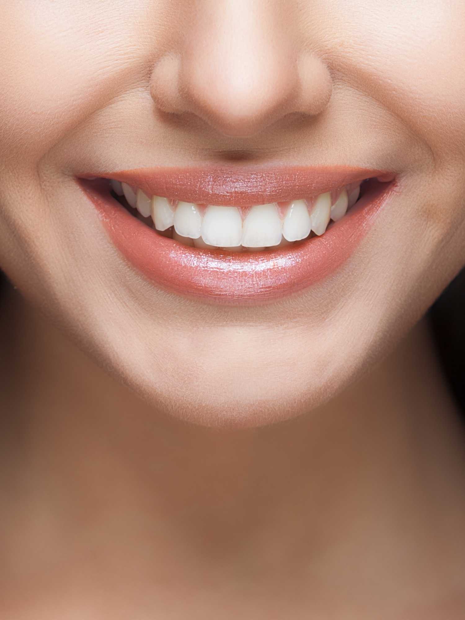 Teeth Whitening TAS