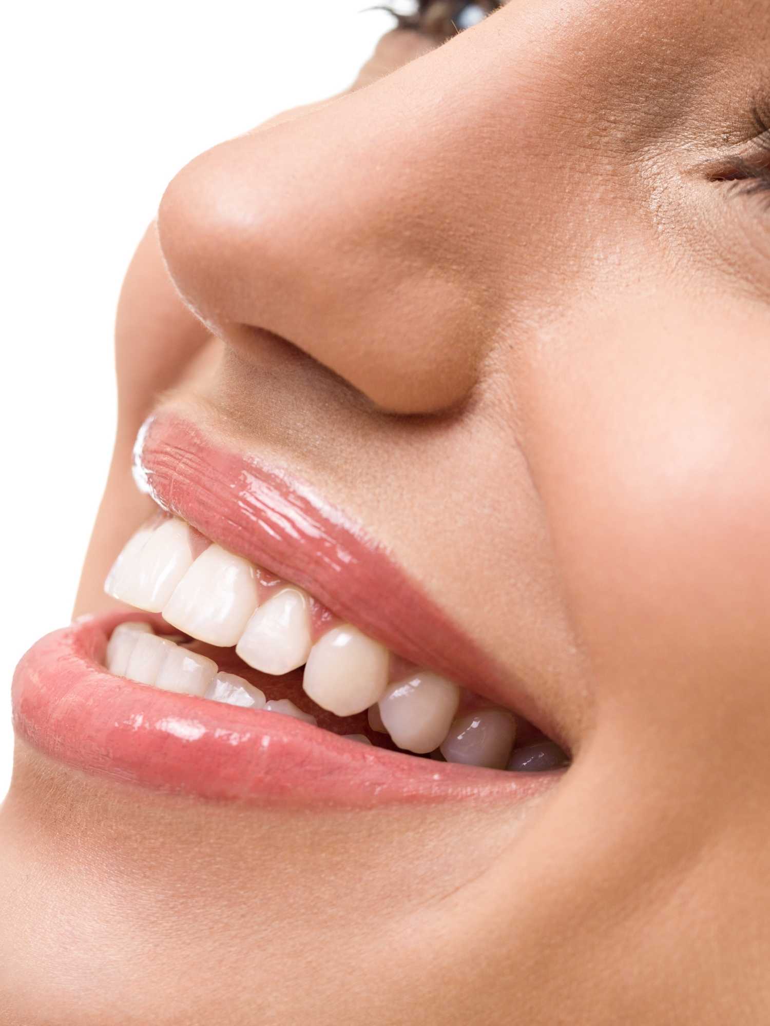Teeth Whitening VIC